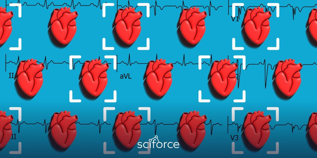 ML-Driven ECG Interpretation