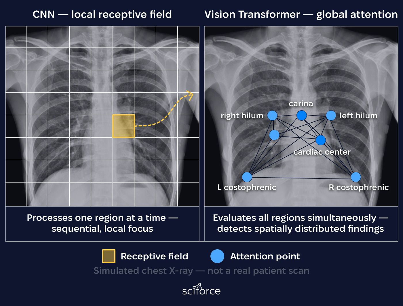 Simulated chest X-ray